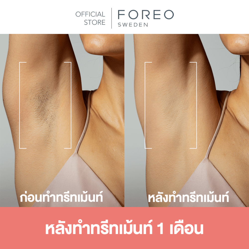เครื่องกำจัดขน IPL FOREO PEACH2 Peach color